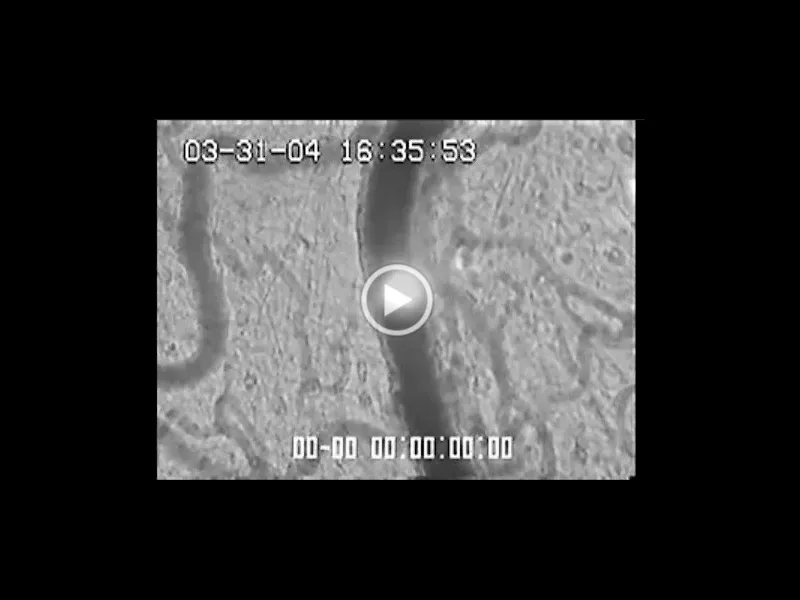 ラット細動脈における血栓形成過程の動画の１場面